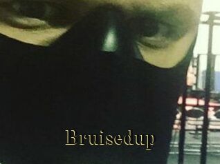 Bruisedup
