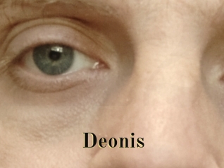 Deonis
