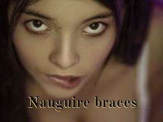 Nauguire_braces