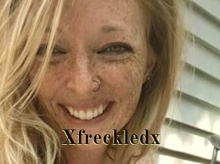 Xfreckledx