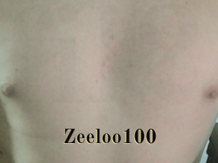 Zeeloo100